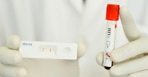 自分で簡単にHIV・エイズかどうか確認できる検査キットの使い方