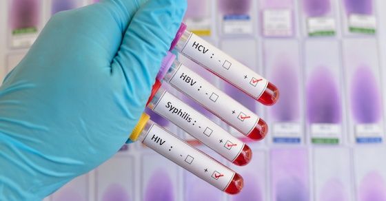 HIV検査キットについて：HIV（エイズ）検査キットを注文する
